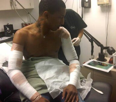 Picture of Pharrell Williams in Laser Surgery Getting Tattoos Removed Picture of Pharrell Williams in Laser Surgery Getting Tattoos Removed