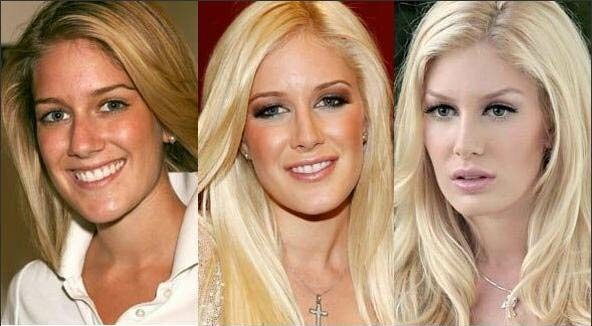 heidi montag plastic surgery regret. Photo of Heidi Montag Before