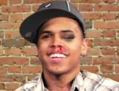 Picture of Chris Brown punched in the face!