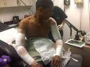 Photo of Pharrell Williams Getting Tattoos Removed With Laser Surgery