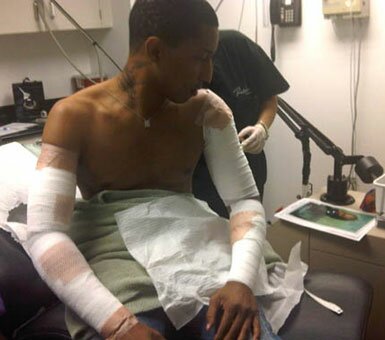 Picture of Pharrell Williams in Laser Surgery Getting Tattoos Removed