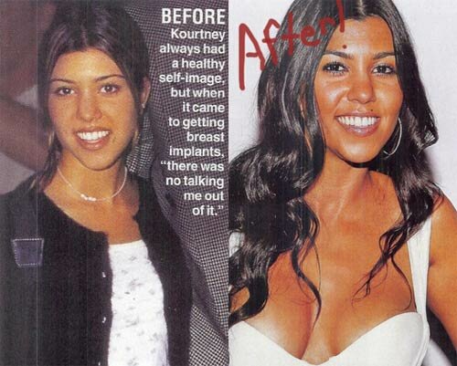 Picture of Kourtney Kardashian Sexy Boob Job - Before and After