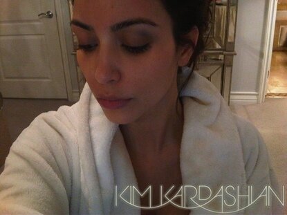 Kim Kardashian With Black Eye
