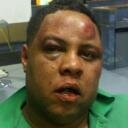 Photo of bruised Cris Hines, Canadian promoter allegedly attacked by Lloyd Banks