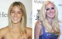 Picture of Heidi Montag Before and After Transformation Plastic Surgery