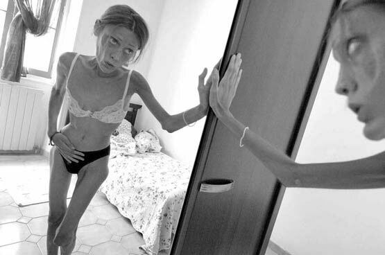 Photo of French Anorexic Model Isabelle Caro in lingerie, underwear